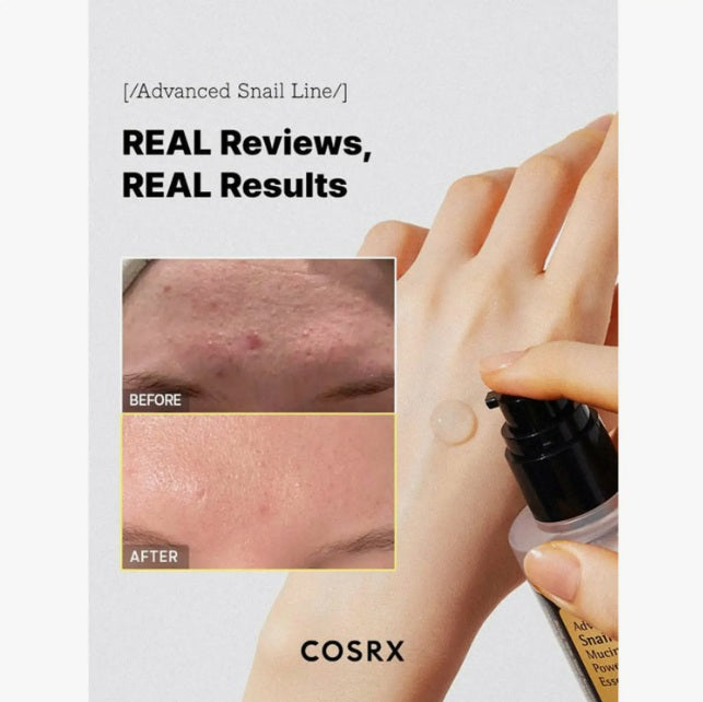 COSRX Advanced Snail 96 Mucin Power Essence 100 mL. Before and After Real Reviews, Real Results.