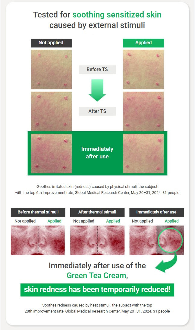 innisfree Green Tea Seed Hyaluronic Cream. Tested for soothing sensitized skin caused by external stimuli.